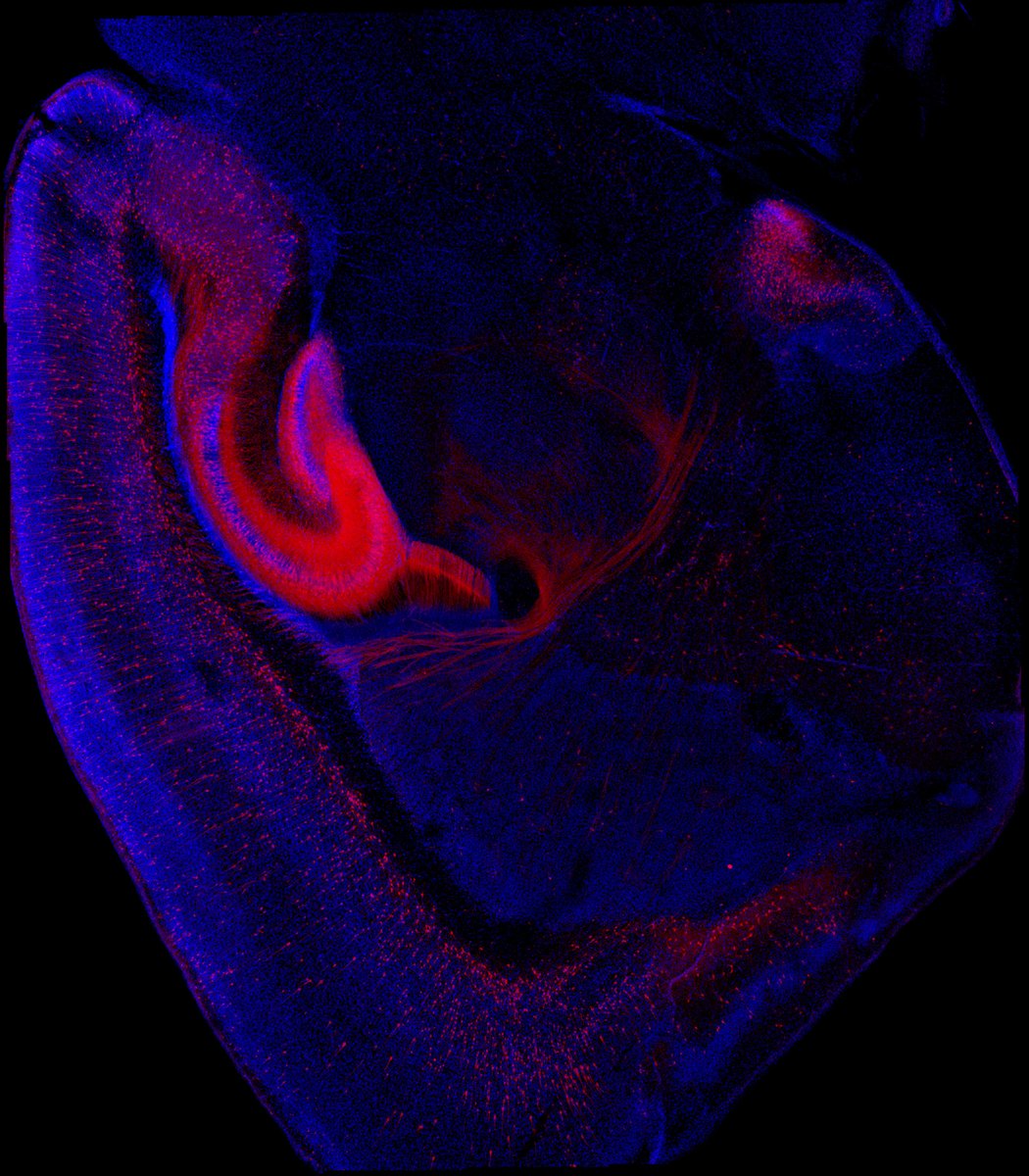NeuroAlc's tweet photo. #SciencePhoto_IN
“¿Corazón o Cerebro?”
Autora: Iris Júarez @Irisjleal
Lab: Dr. Salvador Martínez @SalvaMP1961 Dr. Diego Echevarría @DEchevarria_Aza Dr. Eduardo de Puelles @edepuelles
“Inmunofluorescencia para RFP en una sección sagital de cerebro de ratón donde la...1/2 https://t.co/Lb24L6FW7x