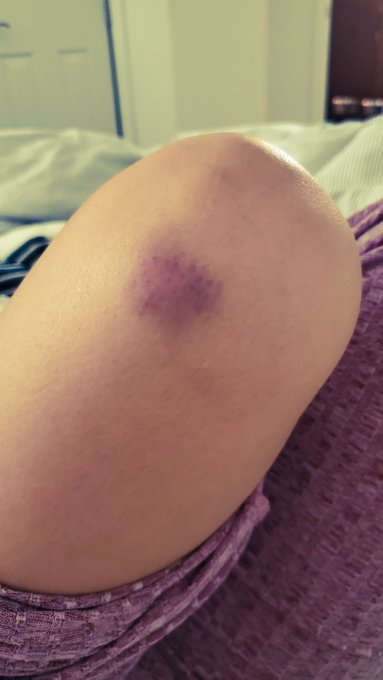 Look what your doggy door did to me @REALMizkif https://t.co/G5E5ixOHZF