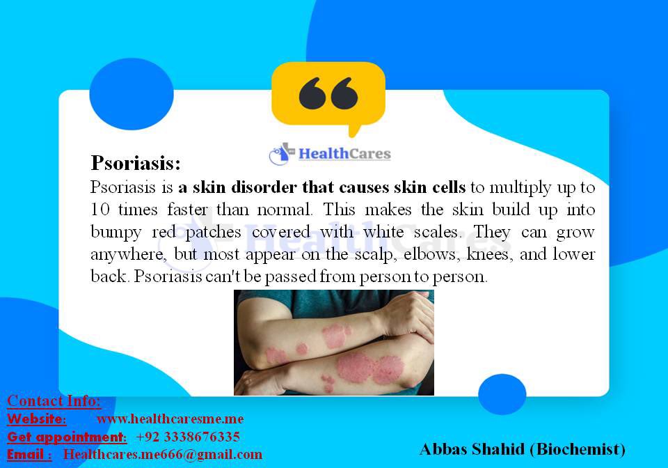Get online appointment at: +92 03338676335