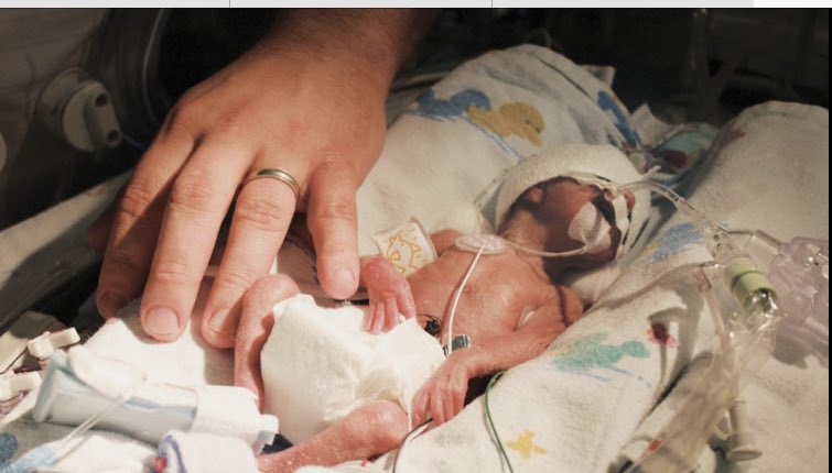 I head obstetrics &amp; neonates. On NICU this am- staff are broken. Such a tragedy for critically ill mothers and their babies that don’t make it but we are also seeing so, so many premature births. Please, please protect yourselves and your precious babies -get covid immunised ASAP