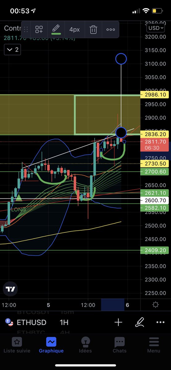 PaulDitrapani2's tweet photo. #eth #pumping 🚀🔥👌😍 https://t.co/9URDbBImTy