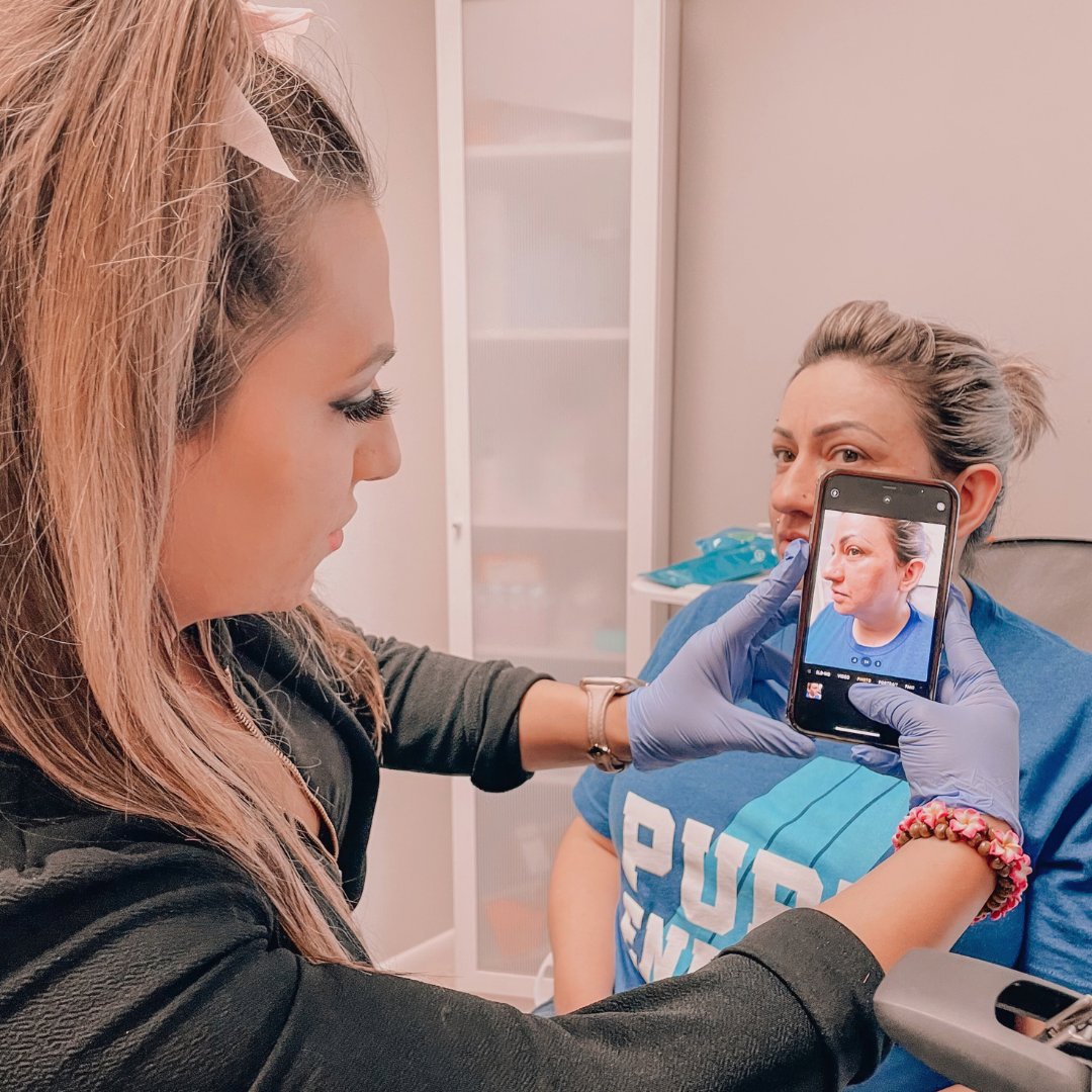 spablackmedspa's tweet photo. We're all about those before pics! 📸 
Before pictures are presented to our patients at the end of their treatment in order to fully bask in the beautiful work that is done! ✨ https://t.co/RCYZlLFLuQ