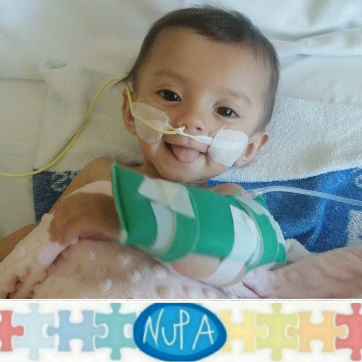 Yaira nació con una enfermedad rara que se llama #gastrosquisis . Ella pasó los primeros meses de su vida ingresada en el Hospital La Paz pero ha conseguido prescindir totalmente de nutrición parenteral y enteral. Qué preciosa eres... 💙🥰  #grandesheroes #fallointestinal