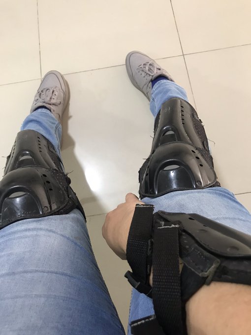 Before, after. Yes even my shins Can sweat like that. I was learning to ride motorcycle. https://t.c