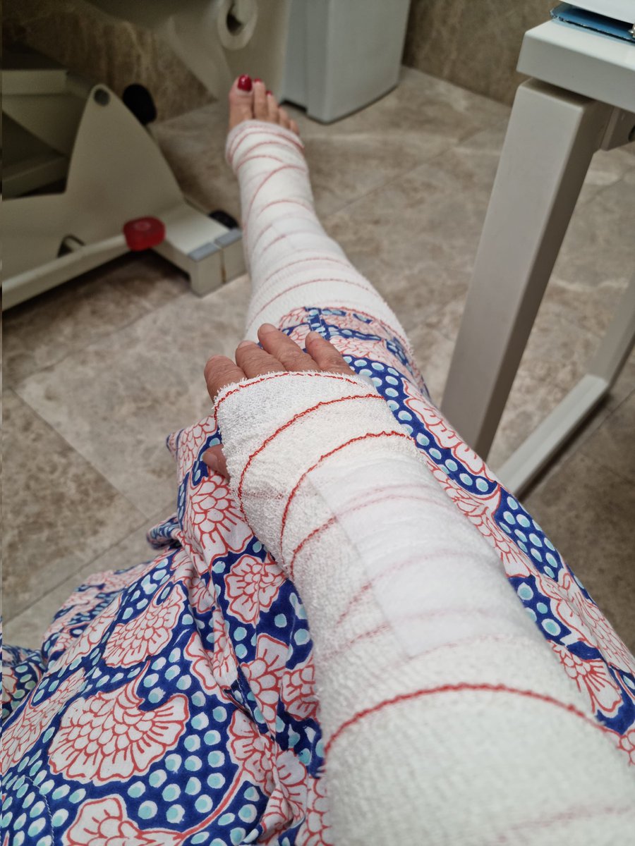 Busco al tipo que me dejó así de guapa ayer: me tiró al suelo con su BMW, delante de la parada del E4 de El Corte Inglés, en la calle Goya. Se llamaba Javier y me dio amablemente su número de teléfono, que ha resultado ser falso.