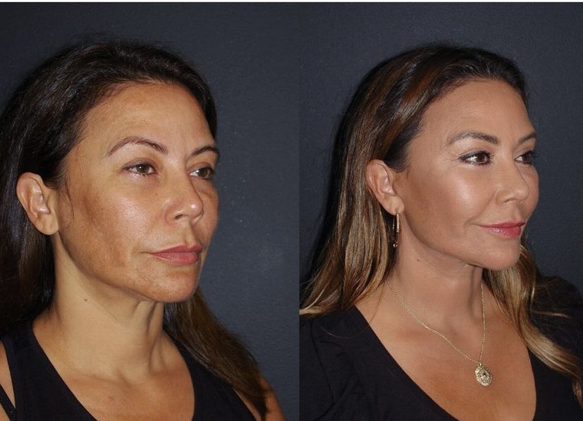 dammiedammie35's tweet photo. This plastic surgeon making old people look young again is one of the best things you’ll see today 🥺🔥 https://t.co/Q6oWkUVmGy