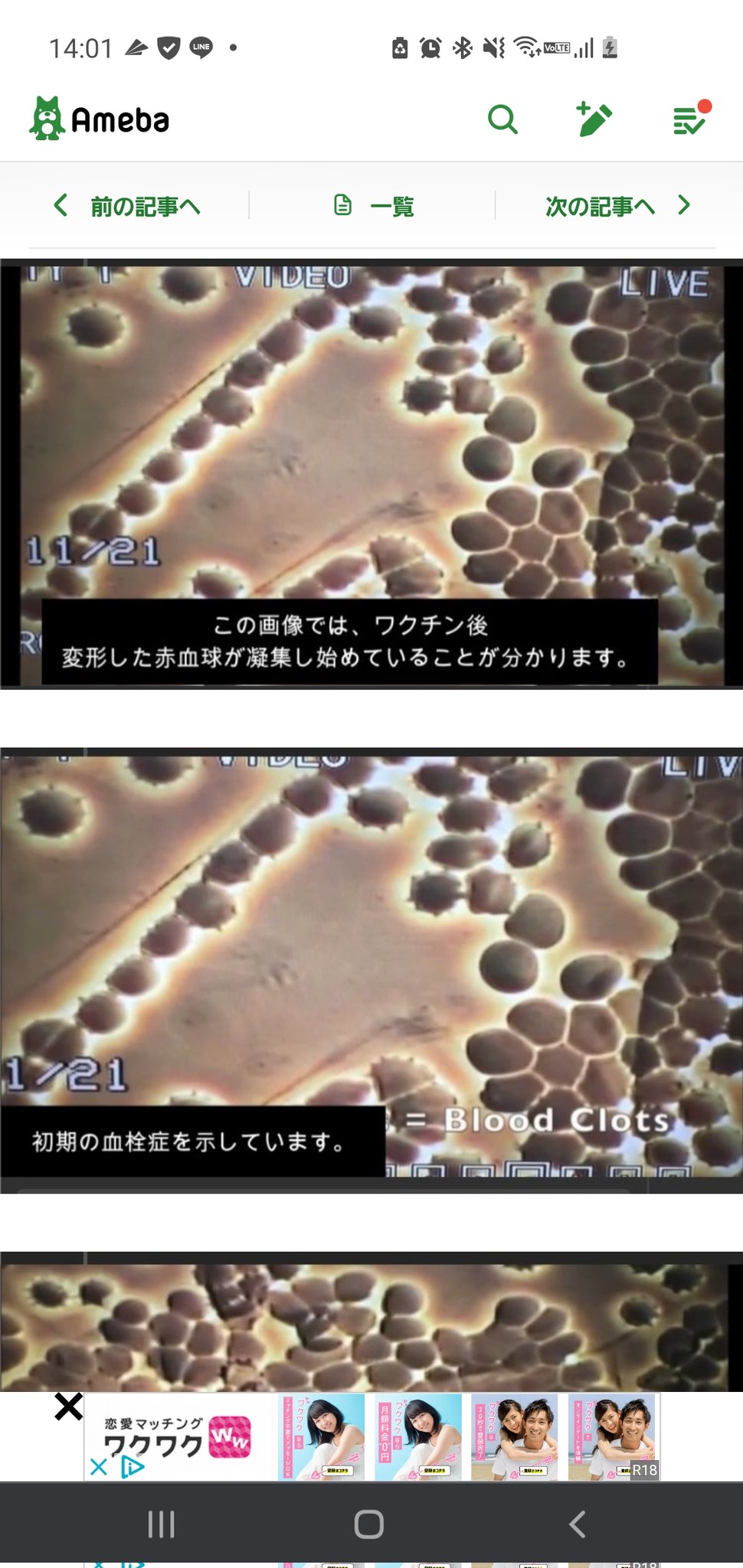 ワクチン接種