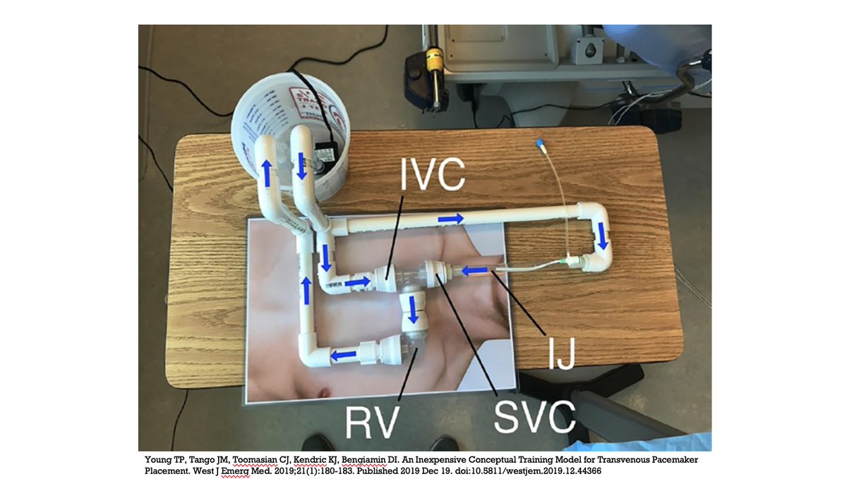 NKahlMD's tweet photo. Transvenous pacemaker placement is an essential procedure in the emergency physician skillset. The procedure can be taught to emergency medicine residents with an easy to assemble model designed and published by Loma Linda EM, and reproduced by @UCSDEMResidency https://t.co/rboXOg7WH7