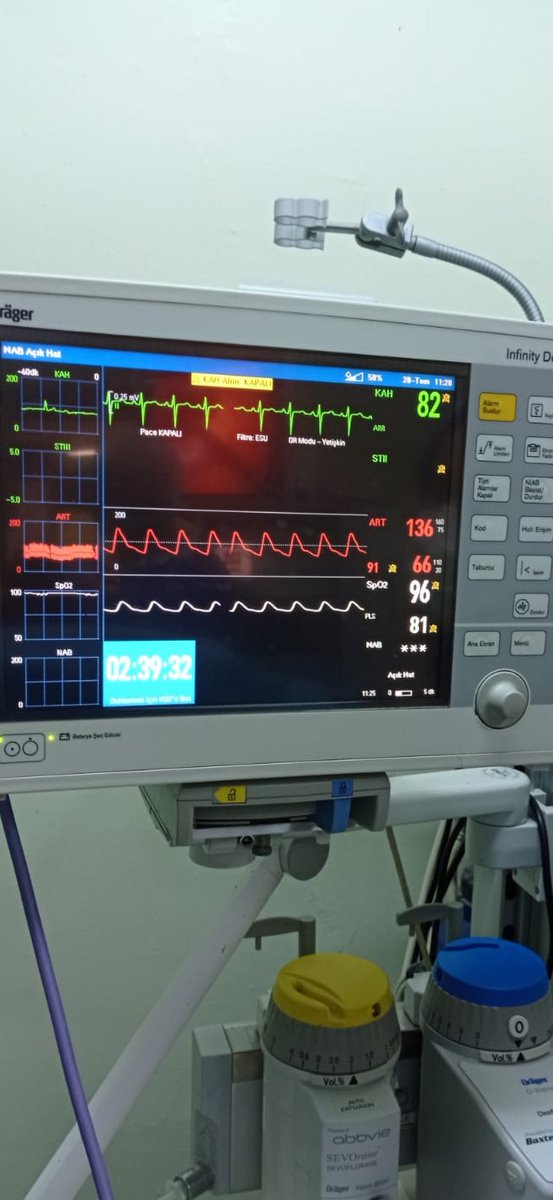 Rektum ca tanısıyla ek kesi olmadan laparoskopik LAR yapılan hastamız 6.gün problemsiz taburcu edildi.