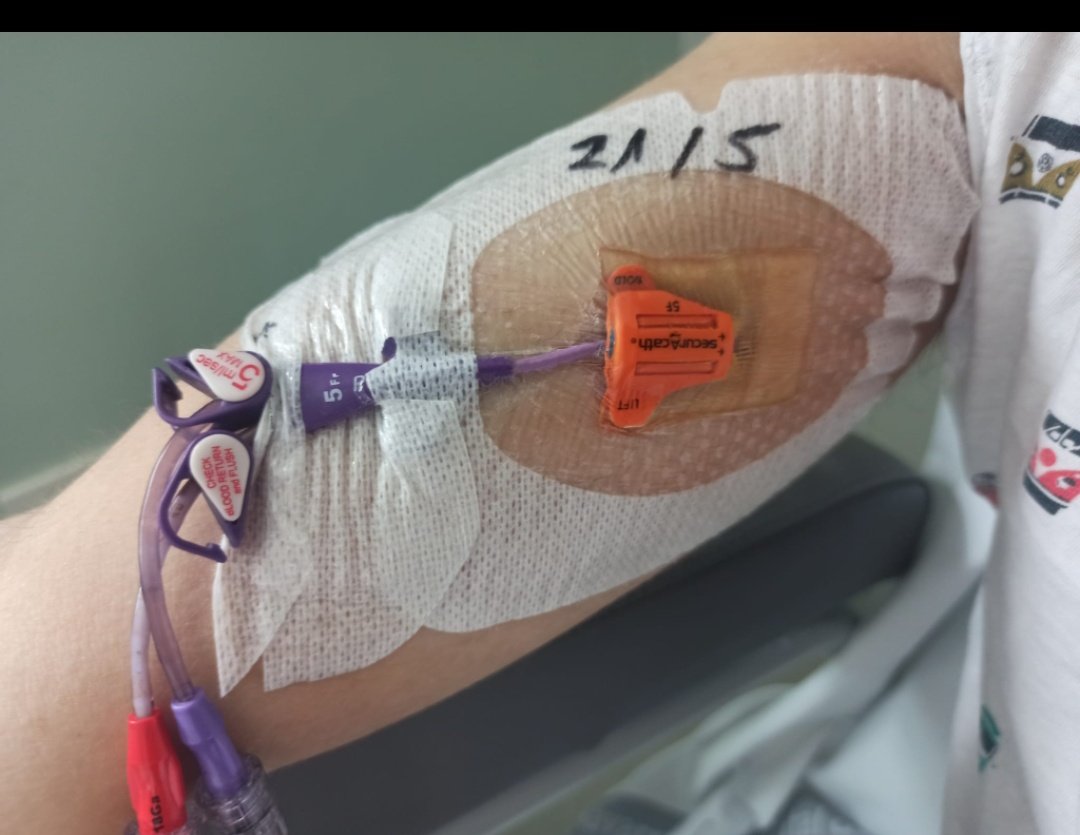 Los PICC son vías centrales de acceso periférico. Más sencillas de colocar y de retirar pero precisan manejo estéril. Se deben dar indicaciones sobre manejo y cuidado a pacientes portadores de PICC #thelineoflife <a href="/BpsoNavarra/">BpsoNavarra</a> <a href="/SomosNupa/">NUPA</a> <a href="/cuidaven/">Cuidaven</a> <a href="/NutriSeen/">NutriSEEN</a> <a href="/PiCuida/">PiCuida</a>