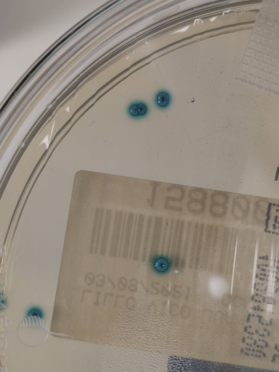 SuBioSam's tweet photo. Azuladas brillantes como piedras preciosas, ¿son ojos? ¿Donuts tal vez? No... Son unas preciosas colonias y vamos a finalizar esta semana con unas fotitos de ellas, aquí os las dejo. ¿Sabéis de qué bacteria se trata? Os leo por los lares microbiológicos 🦠👁 #microC2021 https://t.co/hFirBcNsOQ