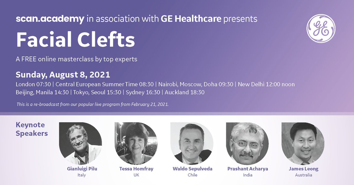 academy is re-broadcasting its popular program about Facial Clefts on August 8, 2021. International top experts G. Pilu (Italy), T. Homfrey (UK), W. Sepulveda (Chile), P. Acharya (India) and J. Leong (Australia). Register now on: webinaronline.in/Scan_Academy/0…