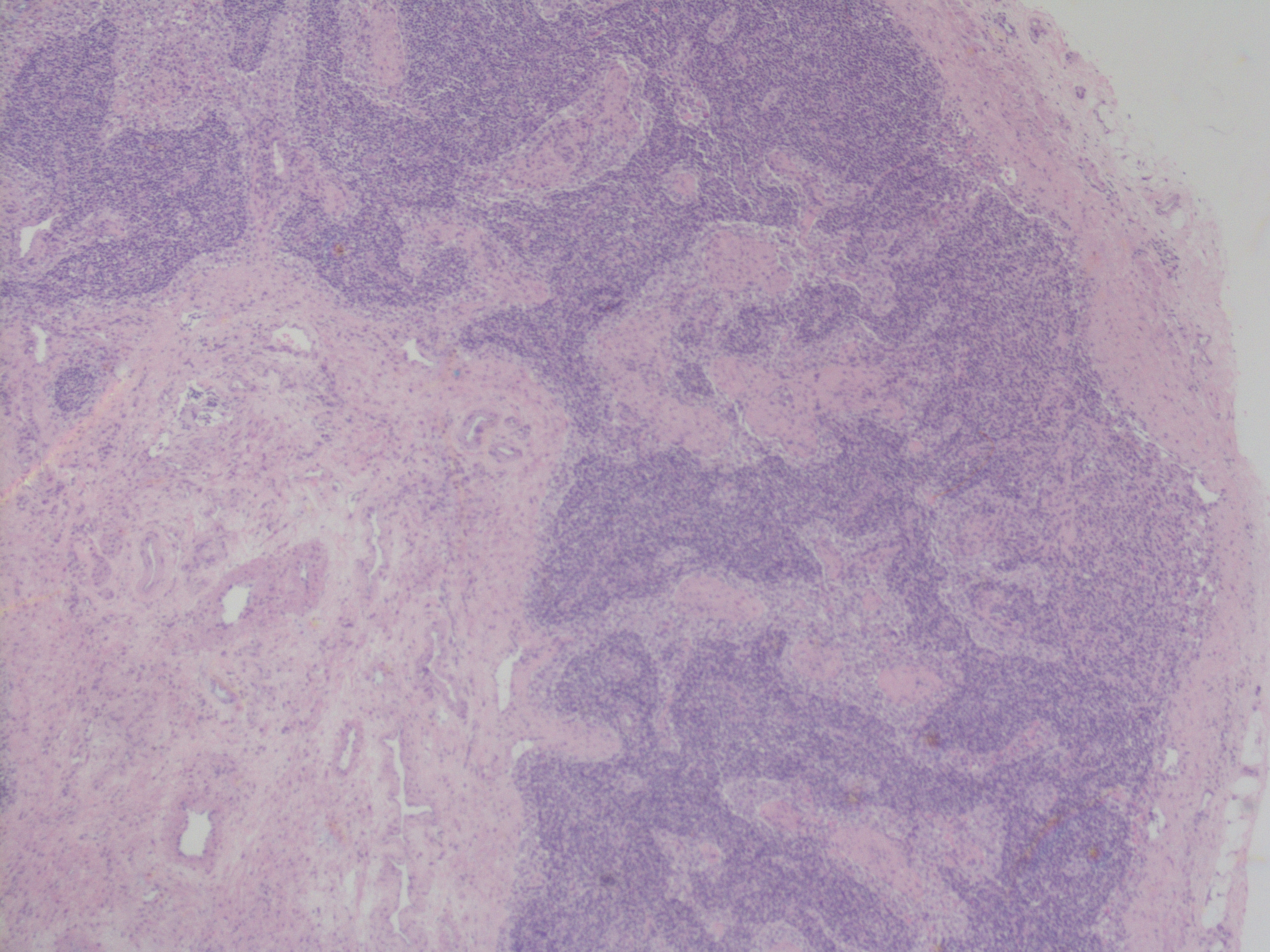 Nouf Pathologyhijazi Twitter