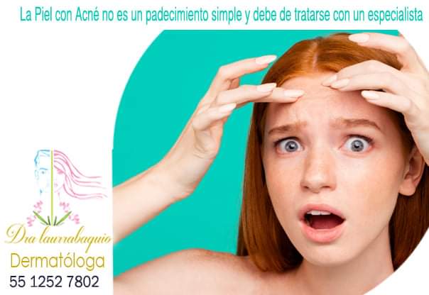 DermaSpaMex's tweet photo. Intente no tocarse la cara ya que manipular las imperfecciones sólo sirve para propagar las bacterias y para empeorar las cosas, nunca para mejorarlas.
#dermatologoscertificados en #AgricolaOriental #CDMX #VenustianoCarranza #Iztapalapa 
Tel: 55 1252 7802 https://t.co/uPPo5hvMaR