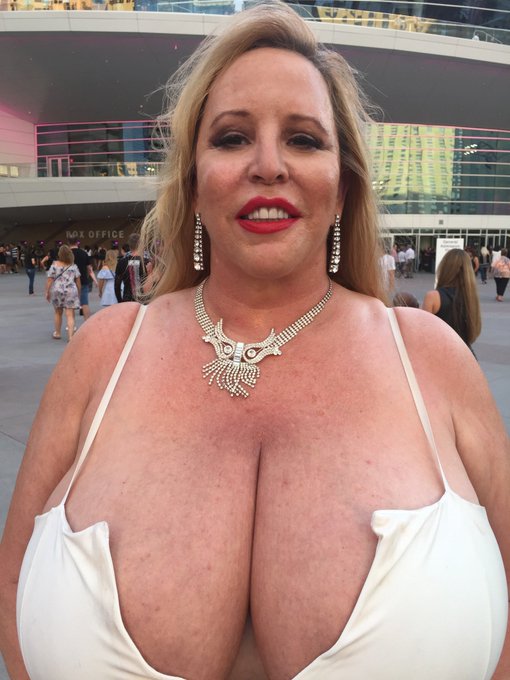 Ortho Dr. Said fracture has moved. 0% weight on for at least 4 more weeks. Need am MRI also.  C him in<a href="/tag/lasvegas"class="tags"><span>#lasvegas</span></a><a href="/tag/church"class="tags"><span>#church</span></a><a href="/tag/onlyfansfans"class="tags"><span>#onlyfansfans</span></a><a href="/tag/europedichan"class="tags"><span>#europedichan</span></a>