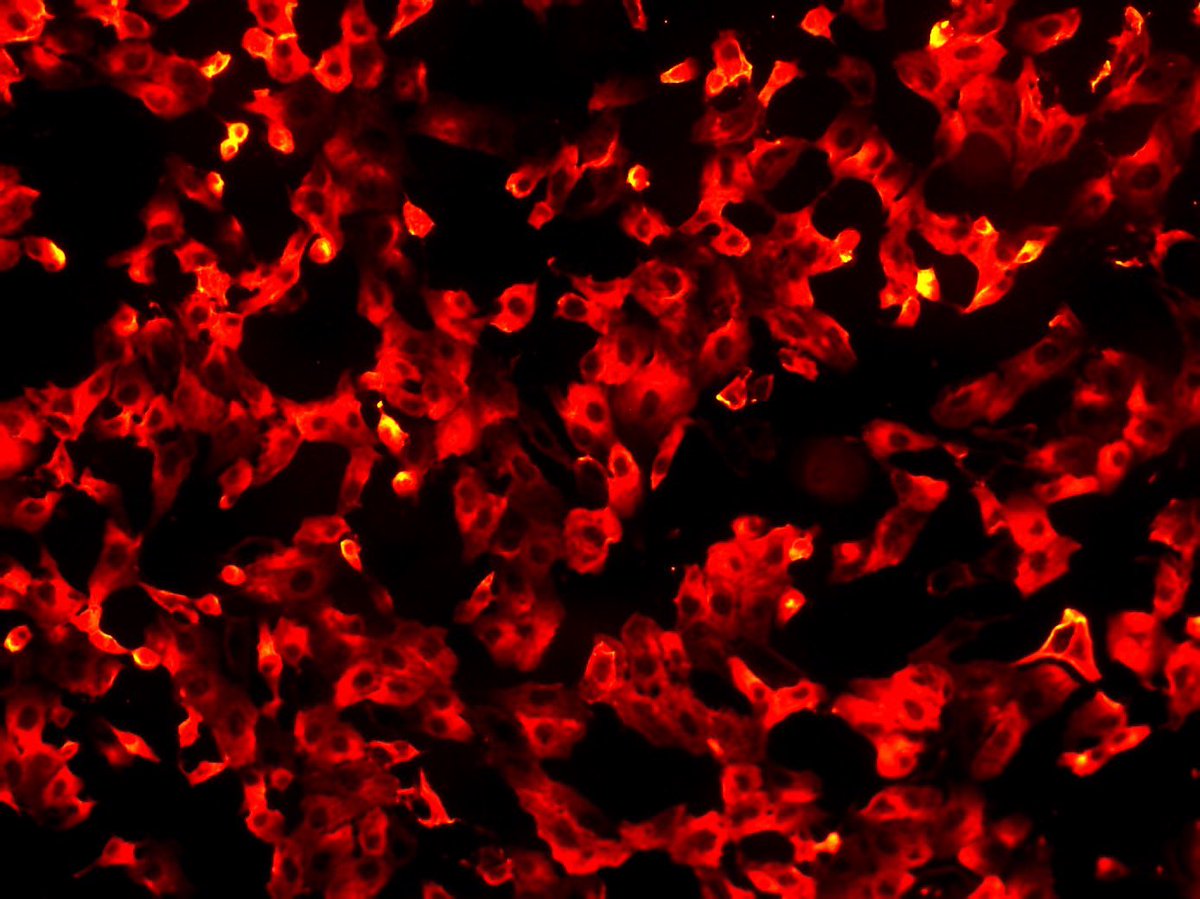 XimengVirology's tweet photo. Seems my cells been used to my spicy 🌶 way 🤣🤣🤣 #phdlife #phd #AcademicChatter https://t.co/nVEjMkGfFb