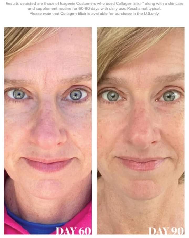 saintdusty's tweet photo. Hi #merseyhour
Step into your glow with our #collagenelixir
Now available in the UK & Europe.
Ageing in reverse :)
Please check out our video 👇
https://t.co/dh0P8EImbz
#botoxinabottle
#type1marinecollagen https://t.co/7ywgVjfB74
