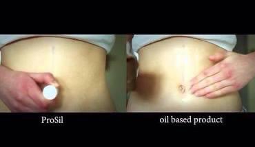 Amredhealthcare's tweet photo. No mess no waste easy to apply and lasts longer than oils and creams this is Award winning Prosil for scarring see https://t.co/WmgsplCiTM for all reviews and information #scar #scars #scarstick #burns #skincare #skin #health #awardwinner #acnescars #scarremoval #nomess #Prosil https://t.co/p6SSlmD3fT