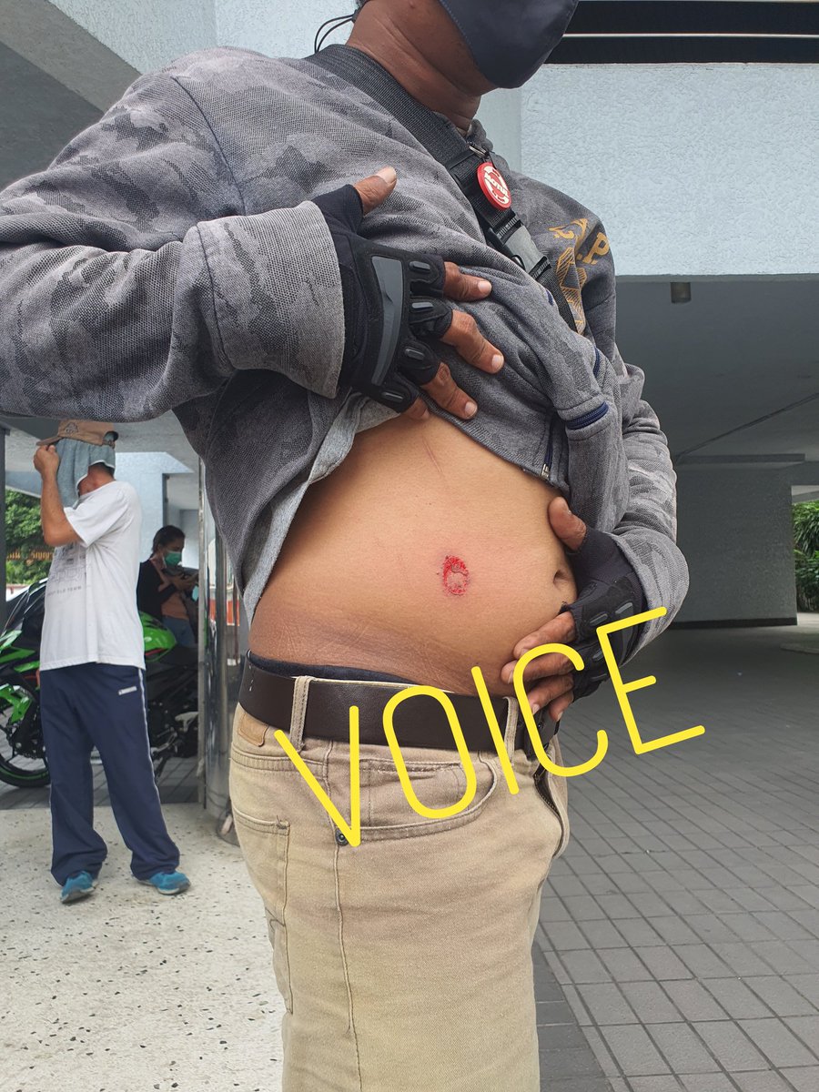 ผู้บาดเจ็บเพียงขับรถผ่านบริเวณแยกดินแดน #ม็อบ7สิงหา