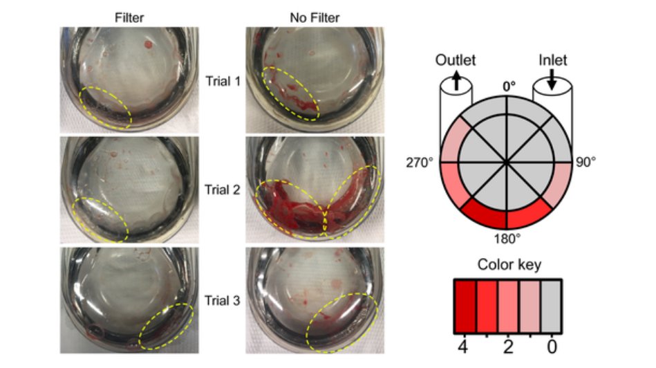 ArtifOrgans's tweet photo. #InVitro #Thrombogenicity testing of #Pulsatile #MechanicalCirculatorySupport systems: #Design and #ProofOfConcept 👇
https://t.co/FzgAD3eXdy
@RWTH 🇩🇪
#Thromboelastometry https://t.co/Bw6u8VvgVw