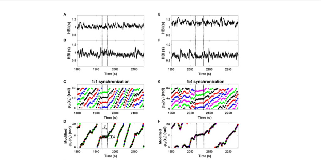 AkhHrs's tweet photo. Human Heart Rhythms Synchronize While Co-sleeping 😴 | Yoon H, Choi SH, Kim SK, et al. | Front Physiol. 2019;10:190 | #heartrhythms #sleep #epeeps #cardiotwitter @FrontPhysiol @SNUnow @EULJIUNIVERSITY | https://t.co/aMY4JrX2K4 https://t.co/CsFlF81KZ7