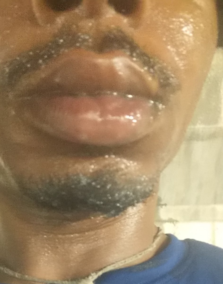 HeadDoctor77's tweet photo. #DickSucker #DickSwallower #Asseater #Bootylicker This just happened π€€ππ
πππ
#Charlottefreaks #Southpark #Underthedeck #Sniffdemnuts I could smell the scent of his funky ass scent while I was sucking that dick ππππ https://t.co/zwWIi16IFi