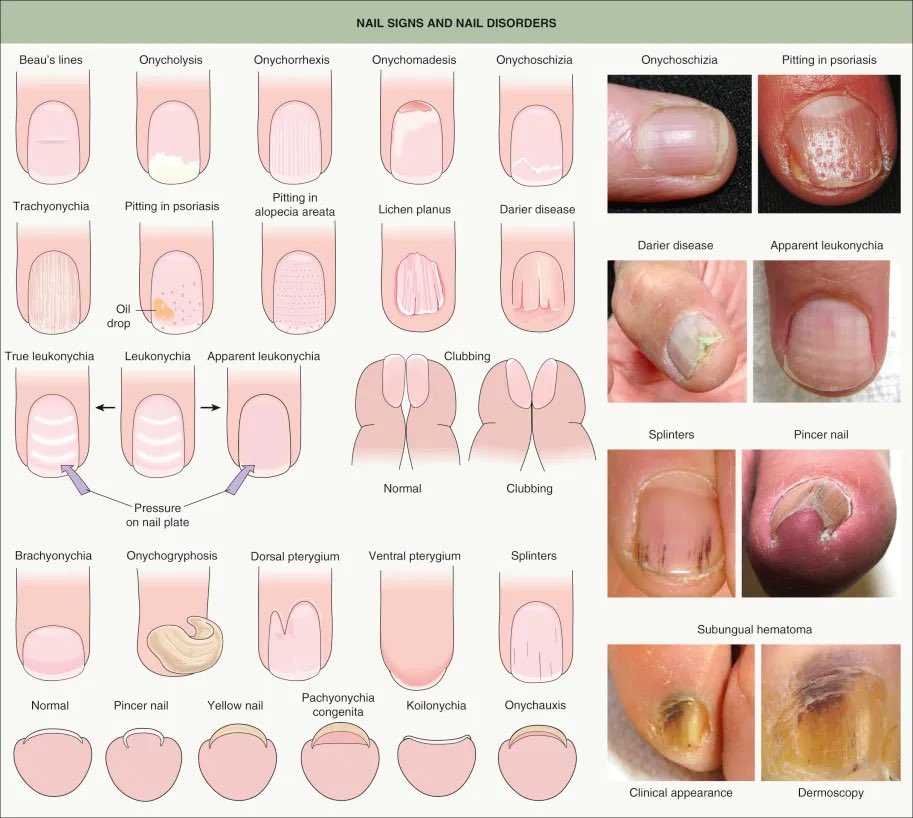 How to Repair Your Nails After Shellac or Polish