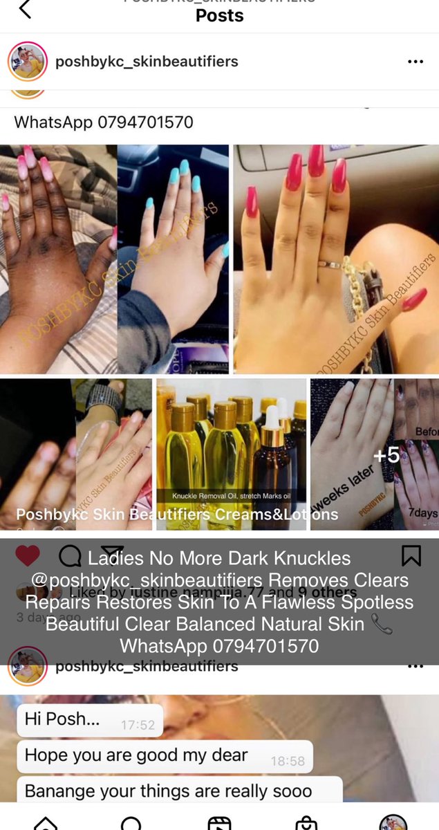 kcbatte's tweet photo. POSHBYKC Skin Beautifiers 
Flawless Spotless Beautiful Glowing Balanced Skin, Guarantee 3Days Natural Glow Fast Results 📞 WhatsApp +256794701570 https://t.co/t5OEUmkiwn