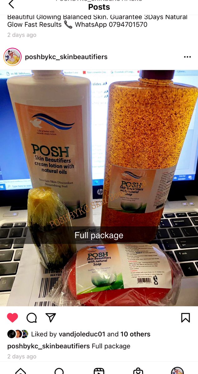 kcbatte's tweet photo. POSHBYKC Skin Beautifiers 
Flawless Spotless Beautiful Glowing Balanced Skin, Guarantee 3Days Natural Glow Fast Results 📞 WhatsApp +256794701570 https://t.co/t5OEUmkiwn