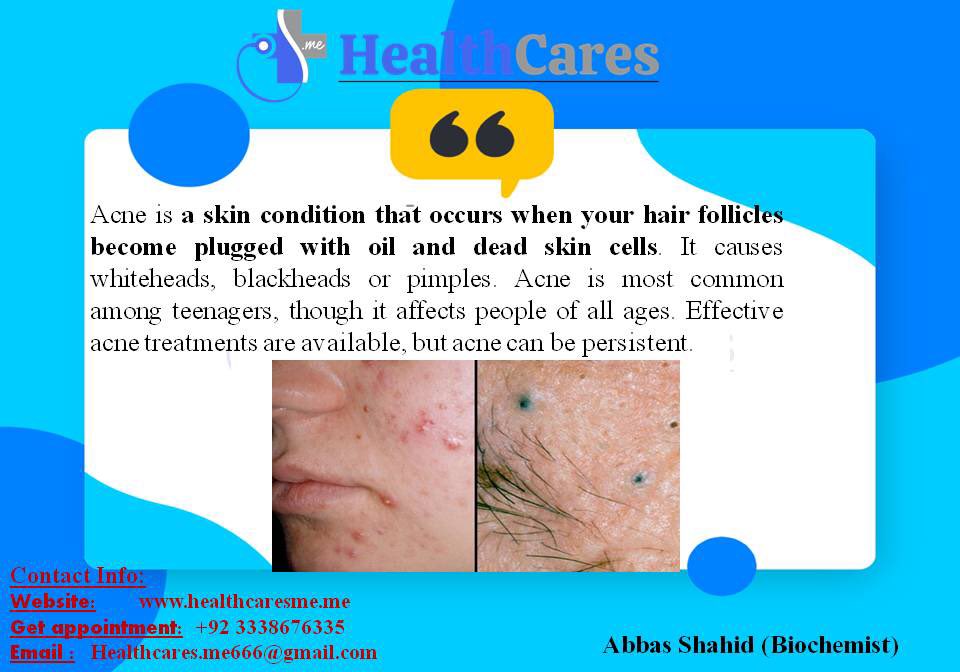 Get online appointment related to health concern at: +92-3338676335