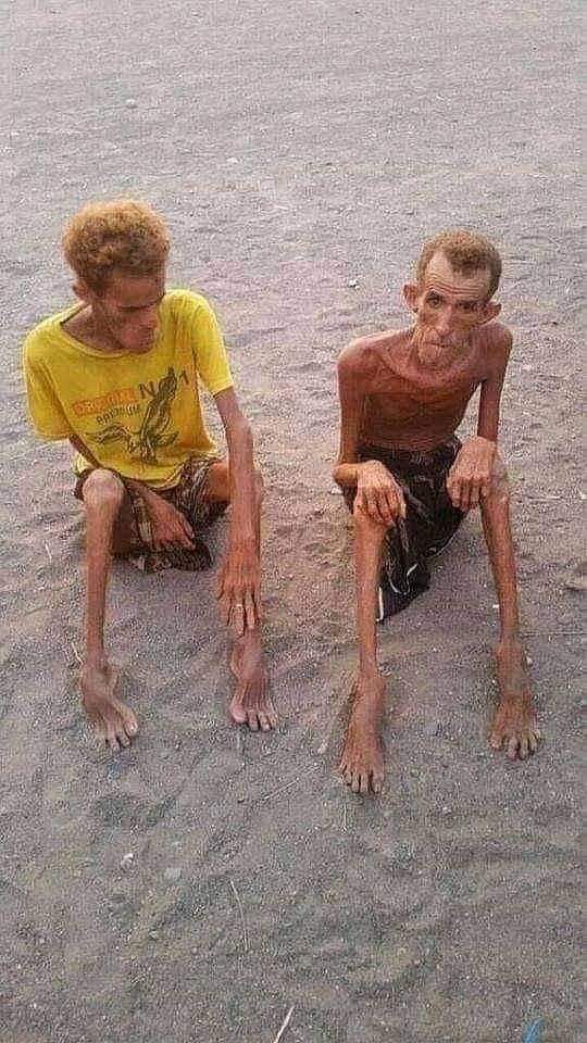 يا عبدربه مركون انظر إلى حال رعيتك وباقي معك ربع متر المسافه الي تفصلك على القبر