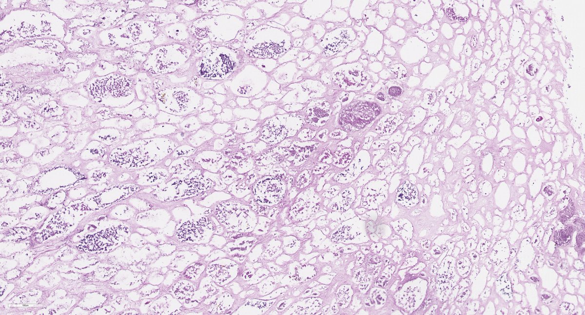 Jonathan Zuckerman MD PhD tweet media