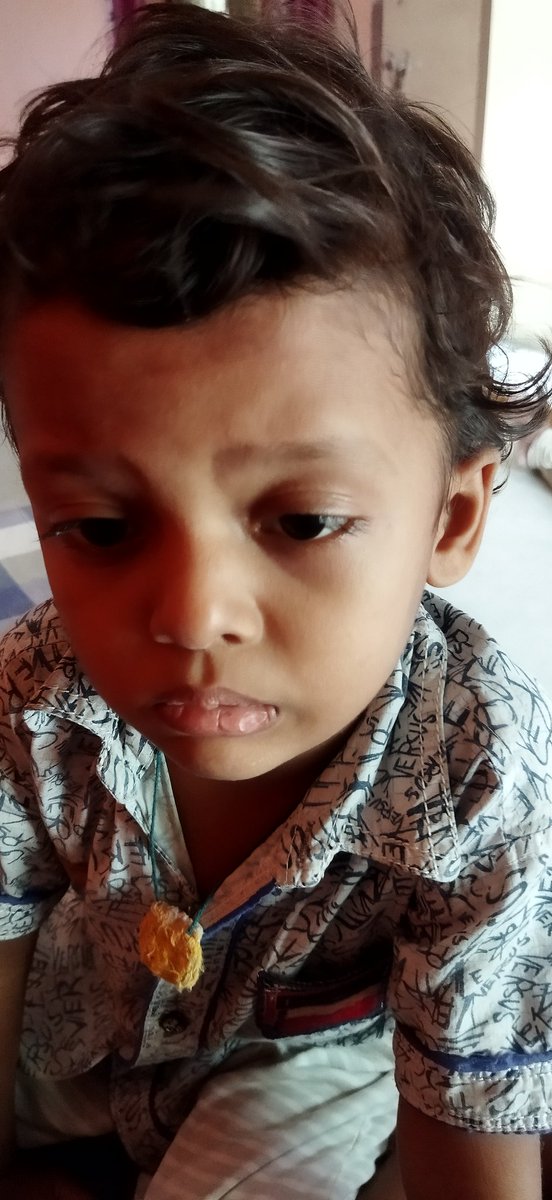 Nenavat64388635's tweet photo. @KTRTRS @KTRoffice  @narendramodi
@kishanreddybjp @SonuSood @offl_Lawrence @AlwaysRamCharan
Please help me sir🙏. My son suffering from SICKLE CELL ANAEMIA.He needs treatment such as BONE MARROW surgery For operation  treatment we required 30 lakhs.please help me sir
 9640220050 https://t.co/uPFmlJL8HQ