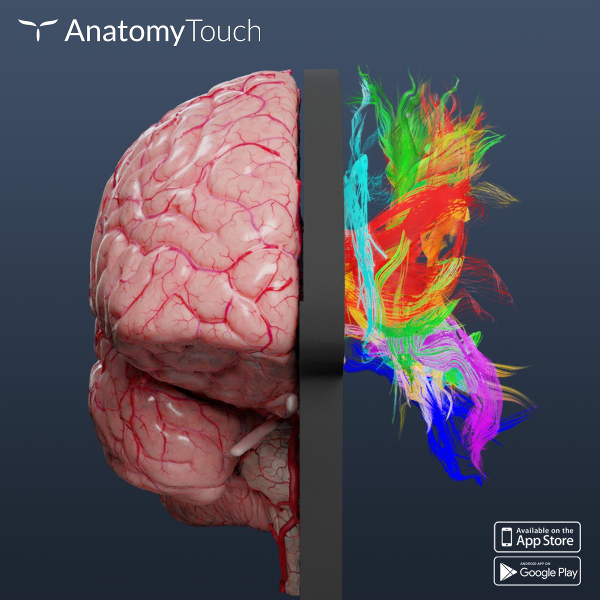 Reality has never been this beautiful!
Discover AnatomyTouch: upsurgeon.com/product/anatom…
.
.
#neuroanatomy #humanbrain #brain #brainanatomy #3Danatomy #anatomystudy #humananatomy #brainanatomy #headanatomy #medicaleducation #training #medstudent #medicine #education