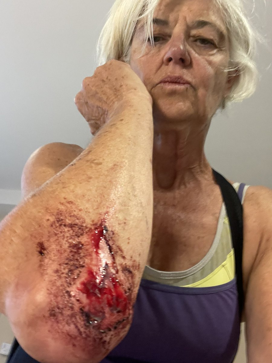 enedoc's tweet image. Just to round off a ‘memorable’ weekend of cycling with blood &amp;amp; bruises galore we have arrived at Aberystwyth station only to find our train cancelled! So, now at the whim of all trains back to bristol accepting us &amp;amp; 2 bikes. @CrossCountryUK @tfwrail #hadenough #wanttobehomenow