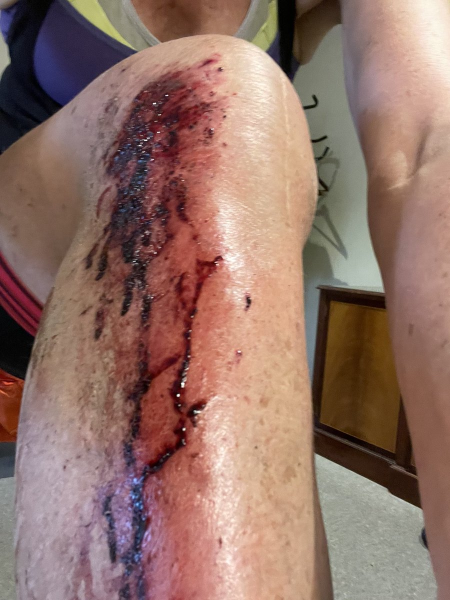 enedoc's tweet image. Just to round off a ‘memorable’ weekend of cycling with blood &amp;amp; bruises galore we have arrived at Aberystwyth station only to find our train cancelled! So, now at the whim of all trains back to bristol accepting us &amp;amp; 2 bikes. @CrossCountryUK @tfwrail #hadenough #wanttobehomenow