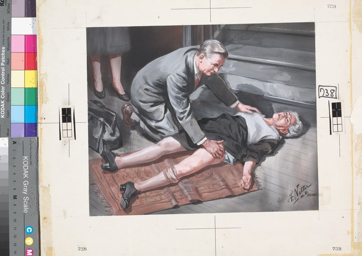FNetterMD's tweet image. From Francine Mary Netter, daughter of Frank H. Netter: “This is a painting dad did of a woman who had fallen and broken her hip. The doctor…was modeled after a photo of the artist! [He] also used his wife and children as models, which we were happy to do.”