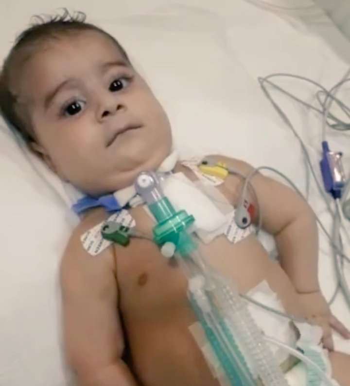 Küçük bedenler büyük işkenceler çekiyor. Vicdanlarınıza dokunmak istiyoruz. Bu çocuklar nefes alamıyor yemek yiyemiyor yürüyemiyor konuşamıyor yataktan çıkamıyor. SMA hastalığının ciddiyetini anlayın ve elinizi uzatın ElimSende #ElimSendeSma