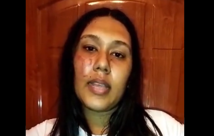 SoyAlejandroGL's tweet photo. VIDEO: La dejaron con el cachete morado tras jornada violenta del Psuv en Lara https://t.co/iNAv773SxL #siempreinformado https://t.co/cKh3WoFCis