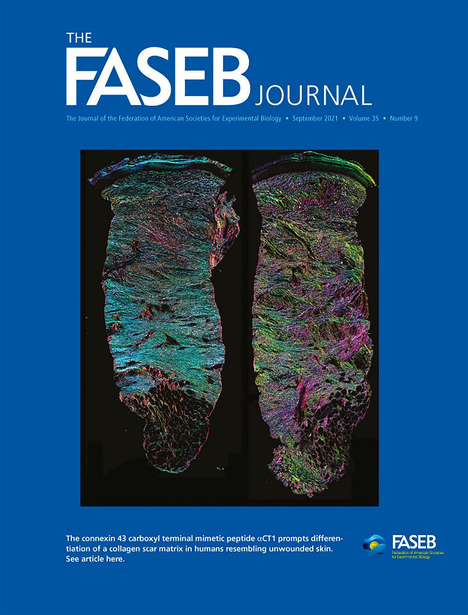 The journal cover image for our FASEB J article Montgomery et al., 2021 has now published - see below. Full article can be found at tinyurl.com/ybpz2trd