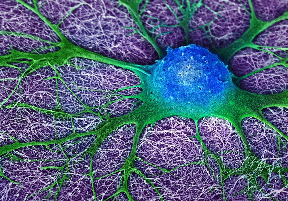 Apply! <a href="/deboramarks/">Debora Marks</a> lab is hiring together with @Jura_Bio - fab opportunity for ML postdoc to work on autoimmune disease with never-before-seen data. Apply at tinyurl.com/immML