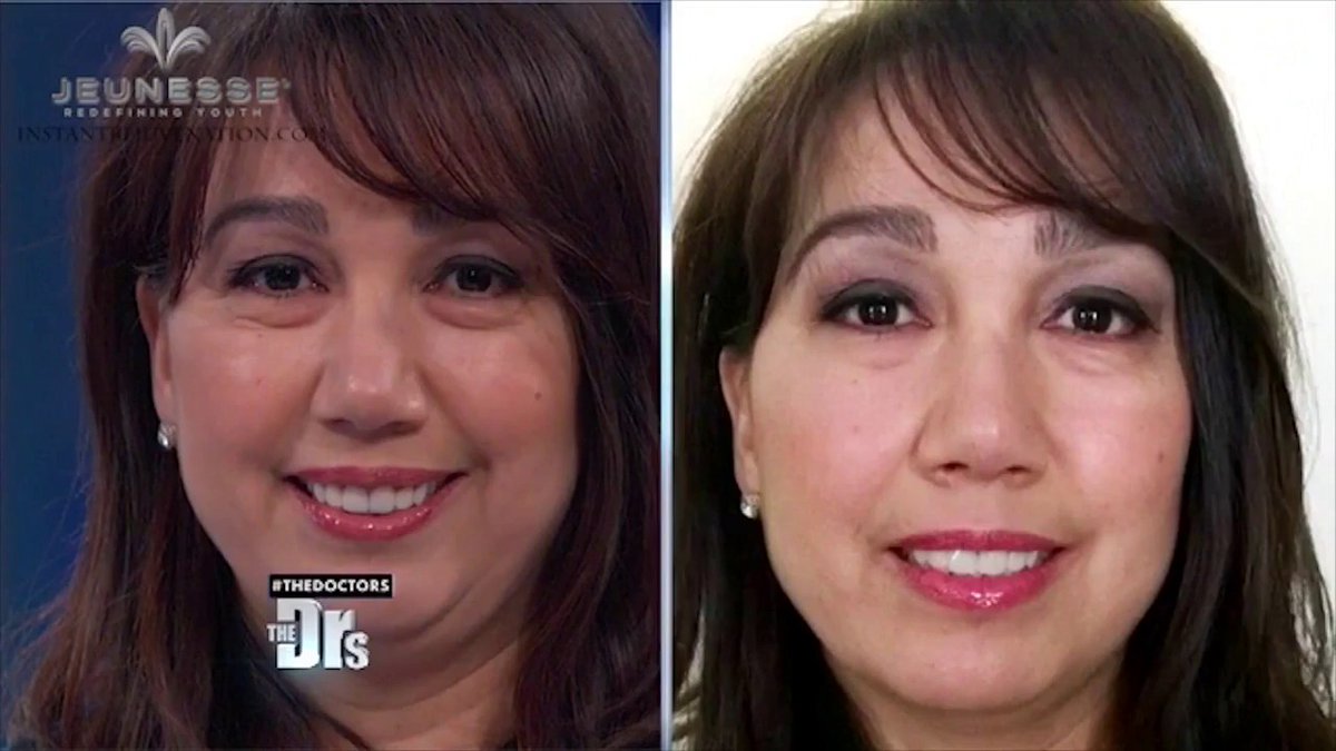 Жми lucky.znaet.in Instantly Ageless на известном американском тв шоу the Doctors TV | Jeunesse dlvr.it/S5H2YM