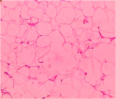 Otolaryngology Cases tweet media
