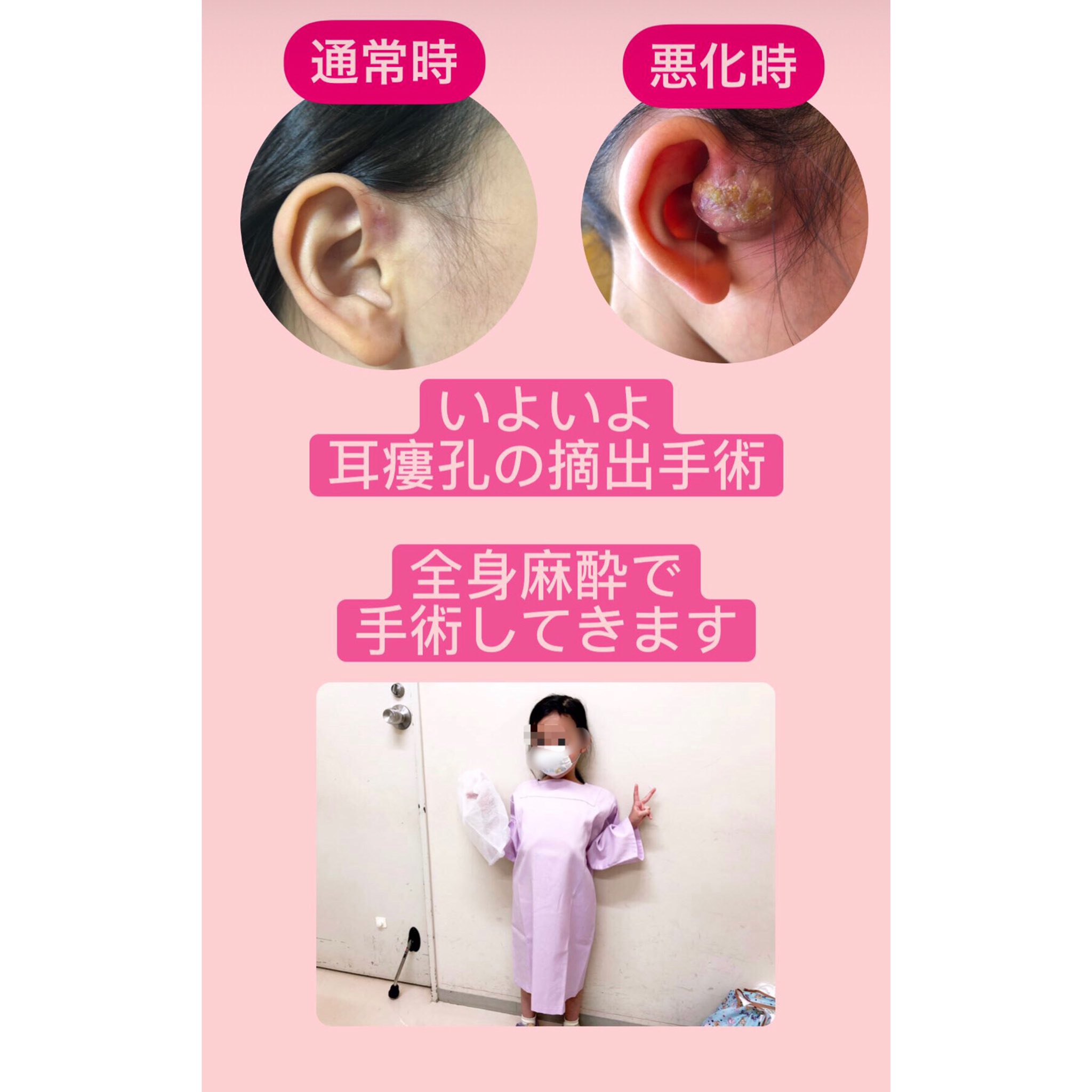 耳瘻孔 Twitter Search Twitter