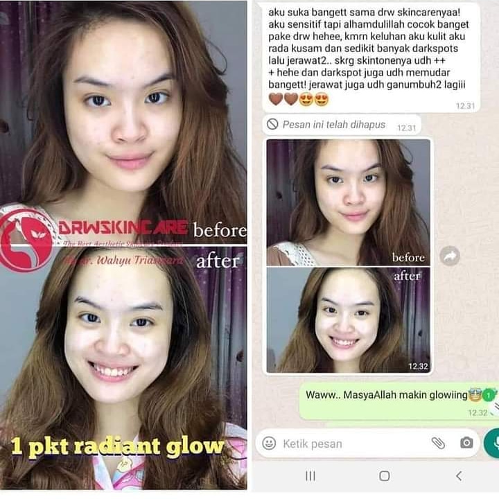 drw_by's tweet photo. Alhamdullilah Testimoni lagi 
Selalu mencoba dan berusaha 
Insaallah drW selalu Memberikan yang terbaik 😁 https://t.co/hixCk41DkK