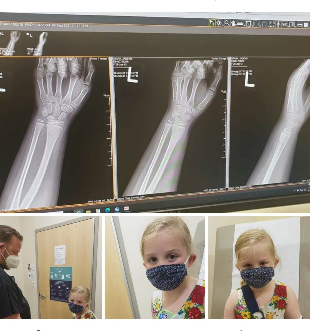 Coffee_w_Krista's tweet photo. That's about enough excitement for this Mama for 1day! Shout Out 2 @MercyJoplin Urgent Care for letting us #COVIDSafe wait in the car and 4 taking such good care of #Jadey!
Jadey is great on skates but we all take a tumble at some point. To Ortho4States for a cast soon, we'll go. https://t.co/DmOAiusQY6