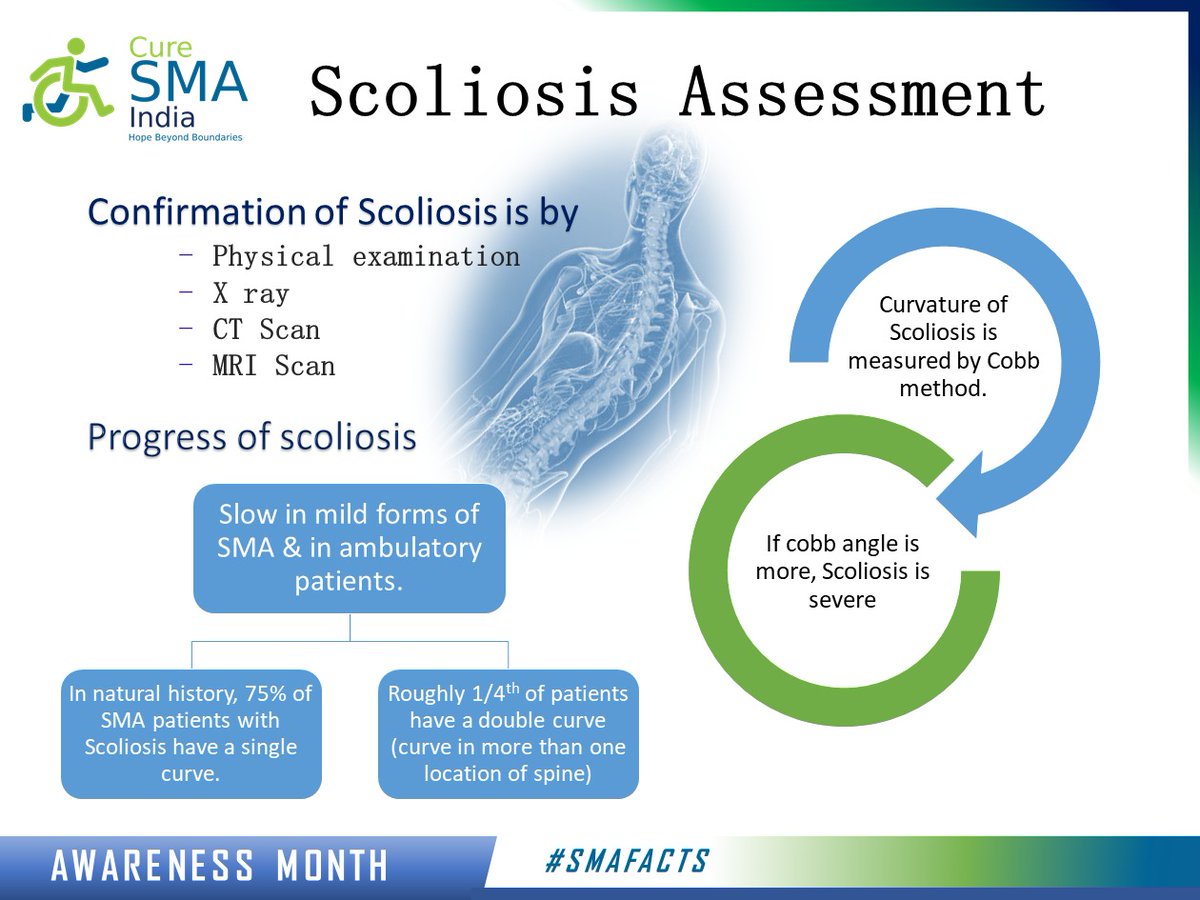curesmaindia's tweet photo. Factsheet on Scoliosis assessment. 
#Scoliosis is usually confirmed through a physical examination, an X-ray, spinal radiograph, CT scan or MRI. The curve is measured by the Cobb Method and is diagnosed in terms of severity by the number of degrees. #SMAfact #awareness #August https://t.co/hUx3dUDeBn
