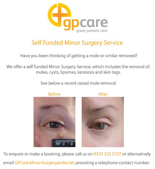 Have you been thinking of getting a mole or similar removed?

See below a recent raised mole removal.

For more information and to book please contact our Minor Surgery Service.