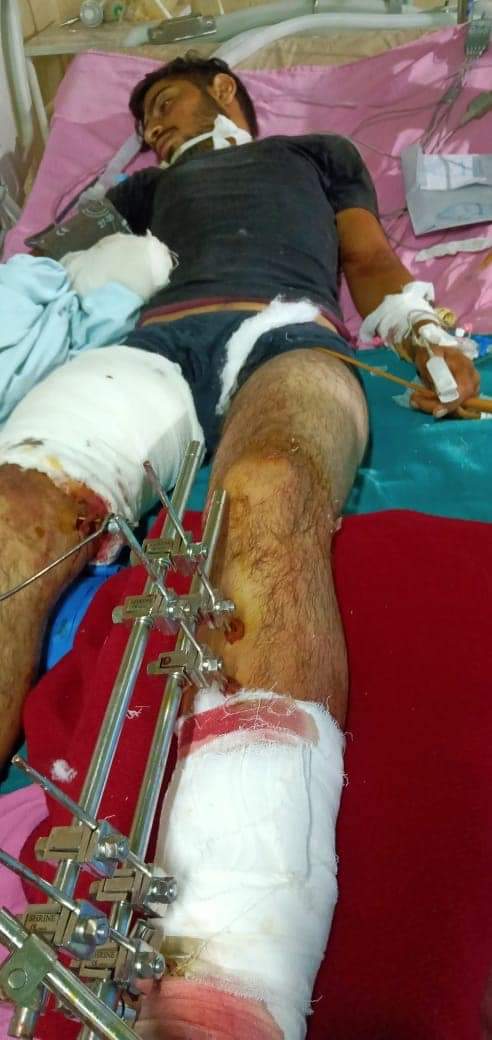 MohitKu43615227's tweet photo. A poor guy named - Abhinandhan Singh resident of Chakwa Batote gone through a massive accident near Chenani and got multiple injuries. He is admitted in GMC Bakshi Nagar Jammu. He is the only support system of his family. A contribution of every single penny will be appreciated. https://t.co/keDp0FLkRP