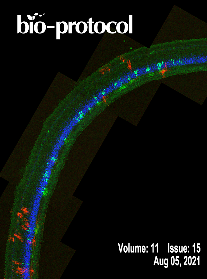 Check out our latest issue here: bit.ly/3xvP7cT

Original research <a href="/NeuroCellPress/">Neuron</a> <a href="/ScienceAdvances/">Science Advances</a> <a href="/JCellBiol/">Journal of Cell Biology</a> <a href="/eLife/">eLife - the journal</a> <a href="/stemcellreports/">StemCellReports</a> <a href="/antibioticsmdpi/">Antibiotics MDPI</a> <a href="/sciencemagazine/">Science Magazine</a> <a href="/NaturePlants/">Nature Plants</a> <a href="/GenesDev/">Genes & Development</a> <a href="/NatureComms/">Nature Communications</a>

#reproducibility #protocols
